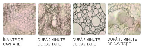 Cavitatie